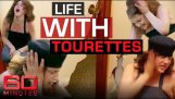 This woman lives with the worst degree of Tourette Syndrome