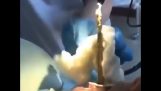 Az orvos egy kígyót húz elő a beteg szájából