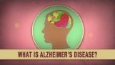 Що таке хвороба Альцгеймера;