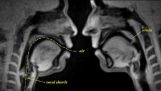 Vie humaine à travers un scanner MRI