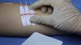 tecnologia alternativa per sostituire le suture mediche