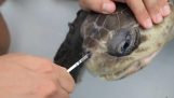 إنقاذ السلاحف البحرية مع سترو بلاستيك في الآنف من