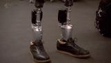 Şaşırtıcı bionikoi ayak bileği