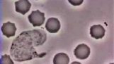 เซลล์เม็ดเลือดขาวไล่แบคทีเรียที่เป็น