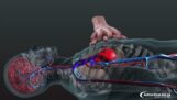 Серцево-легенева реанімація в 3D