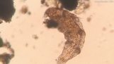Katsellut solunjakautumisen mikroskoopin, όταν ξαφνικά…