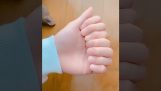 Una mano con ocho dedos