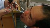 Doctor verwijderen van een bloedzuiger uit de neus van een man