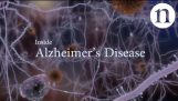 अल्जाइमर रोग के अंदर